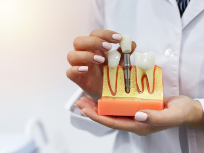  dental implant cost massachusetts