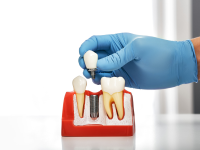new-jersey-oral-surgery-and-dental-implants